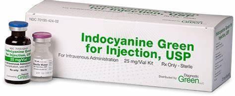 Indocyanine Green for Injection Kit, Angiography (ICG & Sterile water for injection 6/each) 25mg/Vial - Patheon at Stag Medical - Eye Care, Ophthalmology and Optometric Products. Shop and save on Proparacaine, Tropicamide and More at Stag Medical & Eye Care Supply